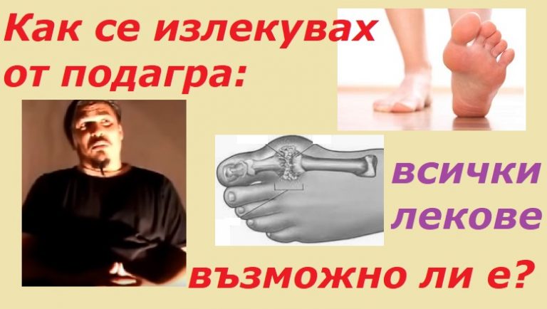 Как се излекувах от подагра, край на подаграта с най-ефикасния лек